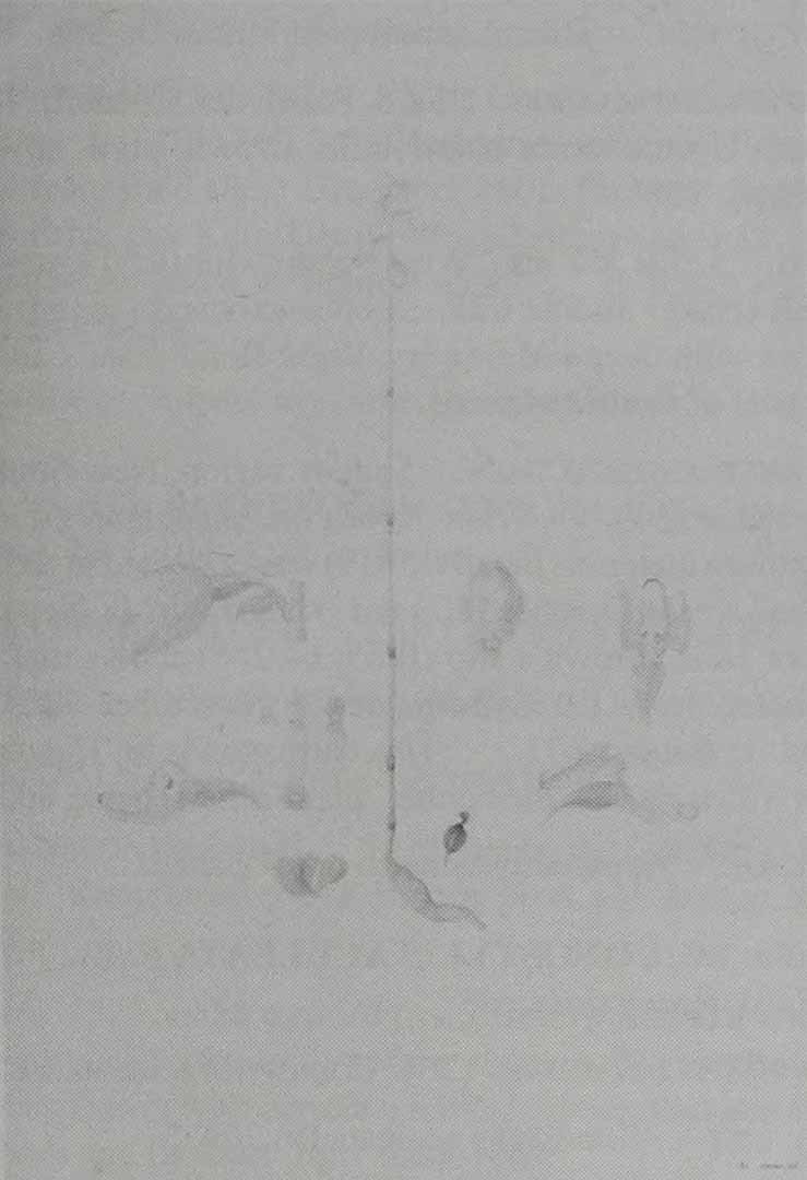 no HD illustration available (3)